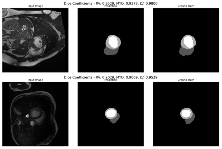 Segmentation Result