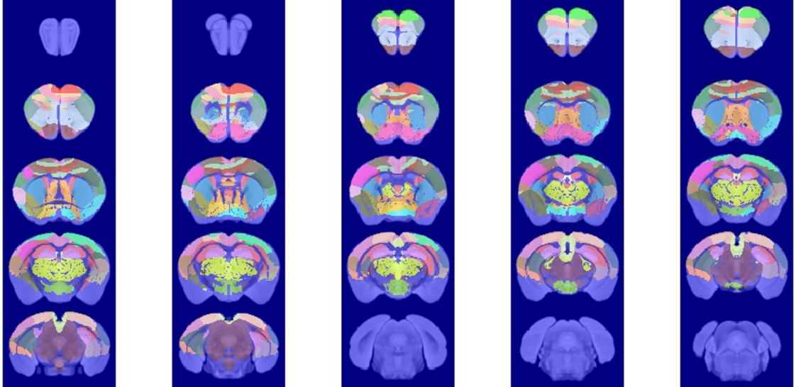 Brain Regions